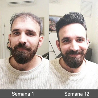 🌿👨‍⚕️ Tienda oficial en EE. UU. 🇺🇸 | 🔥 Champú y acondicionador 2 en 1 PURELORA® de cebolla y romero con complejo activo 15X para el crecimiento capilar: para un cabello con apariencia más gruesa, abundante y fuerte.