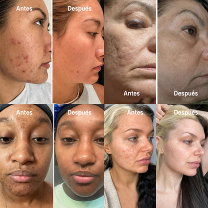 ✨ Purelora® Crema instantánea lifting para el cuello — 🧴 Enriquecida con retinol y ácido hialurónico | Ayuda a reafirmar la piel del cuello, reducir las arrugas y mejorar la apariencia de la papada