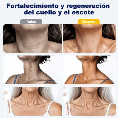 ✨ Purelora® Crema instantánea lifting para el cuello — 🧴 Enriquecida con retinol y ácido hialurónico | Ayuda a reafirmar la piel del cuello, reducir las arrugas y mejorar la apariencia de la papada